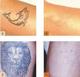 BEST TATTOO REMOVAL CREAM OR GEL.+27785285310